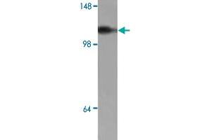 Western blot analysis of human fetal brain tissue lysate with ADCY2 polyclonal antibody  at 1:250 dilution. (ADCY2 Antikörper)