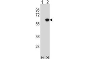 Western Blotting (WB) image for anti-Nucleosome Assembly Protein 1-Like 1 (NAP1L1) antibody (ABIN3000776) (NAP1L1 Antikörper)