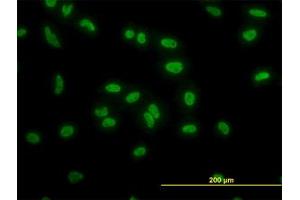 Image no. 3 for anti-TATA Box Binding Protein Associated Factor 11 (TAF11) (AA 158-211) antibody (ABIN598956) (TAF11 Antikörper  (AA 158-211))