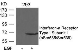 Western blot analysis of extracts from 293 cells untreated or treated with EGF using Interferon-a Receptor Type I Subunit I (phospho-Ser535/Ser539) Antibody. (IFNAR1 Antikörper  (pSer535, pSer539))