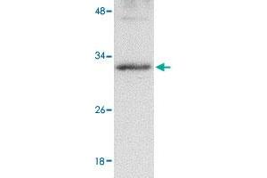 Western blot analysis of GNPDA2 in human kidney tissue lysate with GNPDA2 polyclonal antibody  at 1 ug/mL . (GNPDA2 Antikörper  (C-Term))
