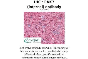 Image no. 1 for anti-P21 Protein (Cdc42/Rac)-Activated Kinase 7 (PAK7) (Internal Region) antibody (ABIN1737840) (PAK7 Antikörper  (Internal Region))