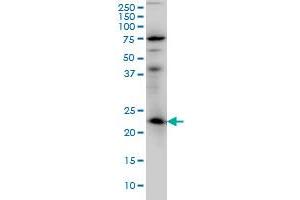 RAB3A monoclonal antibody (M01), clone 4H7 Western Blot analysis of RAB3A expression in IMR-32 .