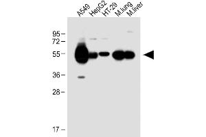 All lanes : Anti-ALDH1A1 Antibody (Center) at 1:1000 dilution Lane 1: A549 whole cell lysate Lane 2: HepG2 whole cell lysate Lane 3: HT-29 whole cell lysate Lane 4: Mouse lung lysate Lane 5: Mouse liver lysate Lysates/proteins at 20 μg per lane. (ALDH1A1 Antikörper  (AA 306-339))