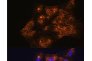 Immunofluorescence (IF) image for anti-Serpin Peptidase Inhibitor, Clade G (C1 Inhibitor), Member 1 (SERPING1) antibody (ABIN7259610)