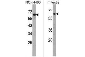 Image no. 1 for anti-Fascin 3 (FSCN3) (N-Term) antibody (ABIN452991) (Fascin 3 Antikörper  (N-Term))