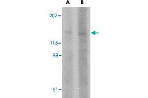 Western blot analysis of BAIAP3 in SK-N-SH cell lysate with BAIAP3 polyclonal antibody  at (A) 1 and (B) 2 ug/mL . (BAIAP3 Antikörper  (N-Term))