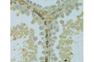 Immunohistochemistry of paraffin-embedded Rat testis using KCNJ1 Polyclonal Antibody at dilution of 1:100 (40x lens). (KCNJ1 Antikörper)