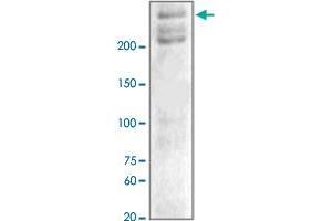 The tissue lysates derived from hypoxic mouse brain were immunoblotted by NF1 polyclonal antibody  at 1 : 1000. (Neurofibromin 1 Antikörper  (C-Term))