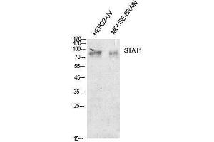 Western Blotting (WB) image for anti-Signal Transducer and Activator of Transcription 1, 91kDa (STAT1) (Internal Region) antibody (ABIN3188009) (STAT1 Antikörper  (Internal Region))