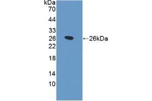Western blot analysis of recombinant Rat SPB. (SFTPB Antikörper  (AA 111-329))