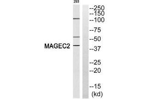 Western Blotting (WB) image for anti-Melanoma Antigen Family C, 2 (MAGEC2) (Internal Region) antibody (ABIN1852688) (MAGEC2 Antikörper  (Internal Region))