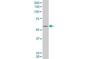 FLI1 monoclonal antibody (M02), clone 2G8. (FLI1 Antikörper  (AA 1-452))