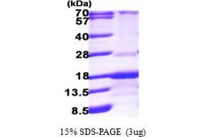 SDS-PAGE (SDS) image for RAB Interacting Factor (RABIF) (AA 1-123) protein (His tag) (ABIN667197) (RABIF Protein (AA 1-123) (His tag))