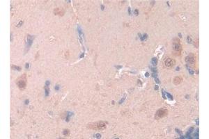 Detection of LEP in Rat Brain Tissue using Polyclonal Antibody to Leptin (LEP) (Leptin Antikörper  (AA 22-167))