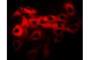 Immunofluorescent analysis of Tropomyosin staining in Hela cells.