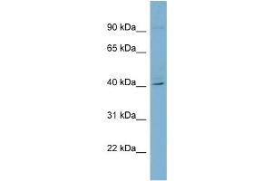 WB Suggested Anti-RFPL3 Antibody Titration: 0. (RFPL3 Antikörper  (Middle Region))