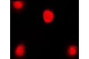 Immunofluorescent analysis of FKBP4 staining in Jurkat cells. (FKBP4 Antikörper)