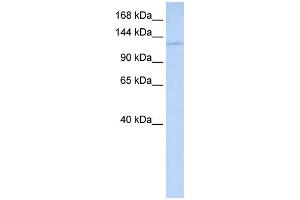 WB Suggested Anti-WDR3 Antibody Titration:  0. (WDR3 Antikörper  (Middle Region))