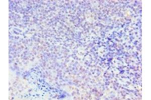 Immunohistochemistry of paraffin-embedded human tonsil tissue using ABIN7160250 at dilution of 1:100 (SMAD9 Antikörper  (AA 1-300))