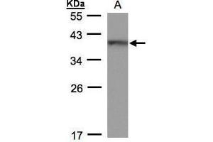 WB Image Sample(30 ug whole cell lysate) A: 293T 12% SDS PAGE antibody diluted at 1:500 (HMG20B Antikörper)