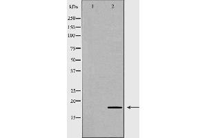 Western blot analysis of extracts of PC3, using BAD antibody. (BAD Antikörper  (Internal Region))