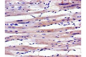 Immunohistochemistry of paraffin-embedded human heart tissue using ABIN7143036 at dilution of 1:100 (ABLIM1 Antikörper  (AA 174-319))