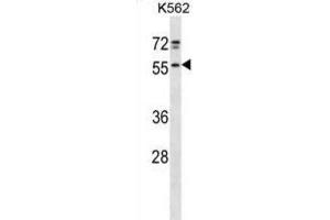 Western Blotting (WB) image for anti-NFS1, Cysteine Desulfurase (NFS1) antibody (ABIN2998727) (NFS1 Antikörper)