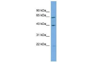 PARD6A antibody used at 1 ug/ml to detect target protein. (PARD6A Antikörper)