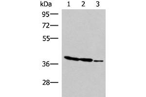 Western blot analysis of HT-29 K562 and HUVEC cell lysates using GIMAP2 Polyclonal Antibody at dilution of 1:1000 (GIMAP2 Antikörper)
