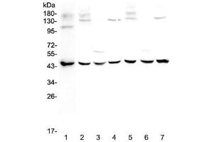 Western blot testing of 1) human MCF7, 2) rat brain, 3) rat kidney, 4) rat testis, 5) mouse brain, 6) mouse kidney and 7) mouse testis lysate with WWOX antibody at 0. (WWOX Antikörper)