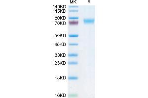 Human Fc epsilon RI alpha on Tris-Bis PAGE under reduced condition. (Fc epsilon RI/FCER1A Protein (AA 26-205) (Fc Tag))