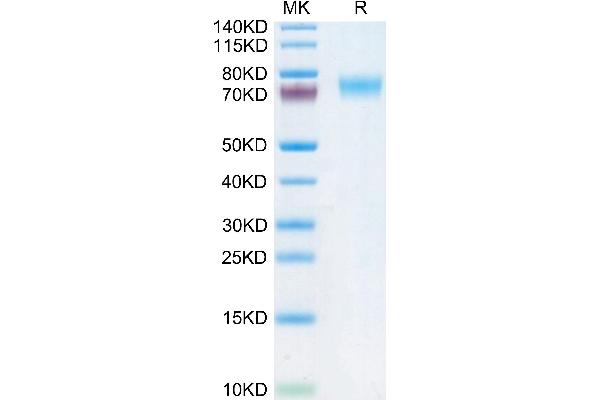 Fc epsilon RI/FCER1A Protein (AA 26-205) (Fc Tag)