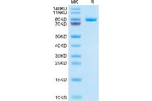 MFI2 Protein (AA 20-709) (His tag)