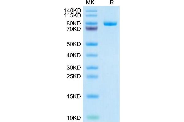 MFI2 Protein (AA 20-709) (His tag)