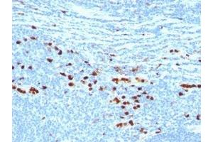 Formalin-fixed, paraffin-embedded human tonsil stained with MRP8 + MPR14 protein antibody (MAC387) (S100A8/A9 Complex (Calprotectin) Antikörper)