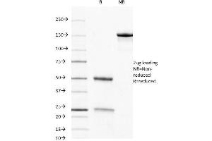 SDS-PAGE Analysis Purified CD8 Mouse Monoclonal Antibody (C8/468). (CD8 alpha Antikörper)