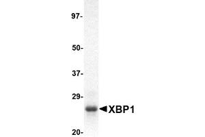 Western Blotting (WB) image for X-Box Binding Protein 1 (XBP1) (AA 2-160) protein (His tag) (ABIN2469226) (XBP1 Protein (AA 2-160) (His tag))