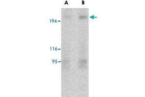 Western blot analysis of TSC2 in L1210 cell lysate with TSC2 polyclonal antibody  at (A) 2 and (B) 4 ug/mL .