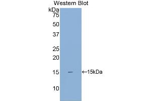 Detection of Recombinant SIGIRR, Human using Polyclonal Antibody to Single Ig IL1 Related Receptor (SIGIRR) (SIGIRR Antikörper  (AA 1-118))