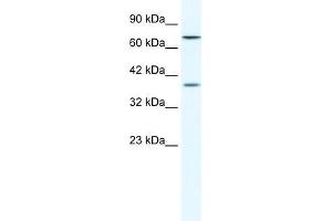 Human HepG2; WB Suggested Anti-ZNF660 Antibody Titration: 1. (ZNF660 Antikörper  (C-Term))