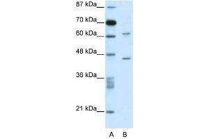 C1ORF25 antibody used at 0. (TRMT1L Antikörper  (N-Term))