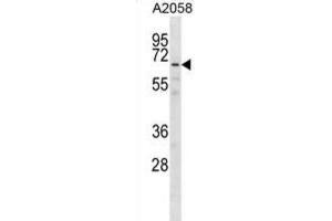 Western Blotting (WB) image for anti-G Patch Domain and KOW Motifs (GPKOW) antibody (ABIN2998795)