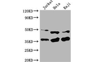 Western Blot Positive WB detected in: Jurkat whole cell lysate, Hela whole cell lysate, Raji whole cell lysate All lanes: NFKBIA antibody at 1:2000 Secondary Goat polyclonal to rabbit IgG at 1/50000 dilution Predicted band size: 36 kDa Observed band size: 36 kDa (NFKBIA Antikörper  (AA 27-317))