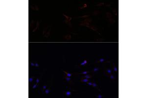 Immunofluorescence analysis of C6 cells using SUCLG1 antibody (ABIN7270623) at dilution of 1:100.