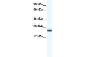 Western Blotting (WB) image for anti-Tubulin Polymerization Promoting Protein (Tppp) antibody (ABIN2461555) (Tppp Antikörper)