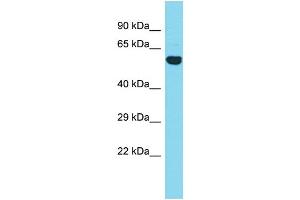 Host: Rabbit Target Name: CCDC149 Sample Type: Fetal Heart lysates Antibody Dilution: 1. (CCDC149 Antikörper  (N-Term))
