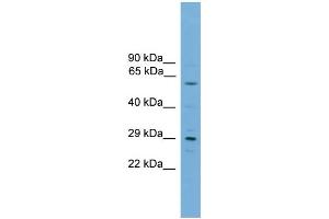 WB Suggested Anti-RPAIN  Antibody Titration: 0. (RPAIN Antikörper  (C-Term))