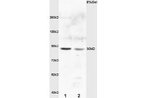 L1 rat kideny lysates L2 rat brain lysates probed with Anti E2F8 Polyclonal Antibody, Unconjugated (ABIN706106) at 1:200 overnight at 4 °C. (E2F8 Antikörper)