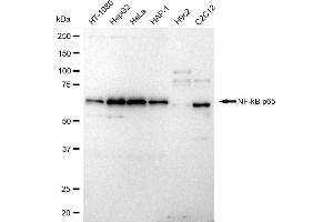 Western blotting analysis using NF-kB p65 antibody (ABIN7799645). (Rekombinanter NF-kB p65 Antikörper)